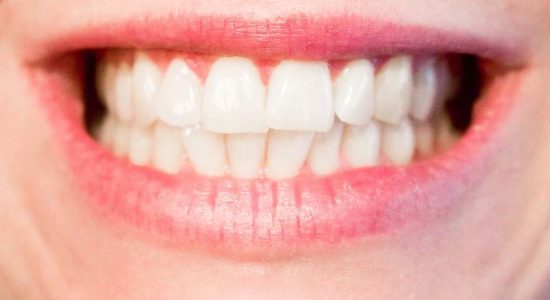 Teeth and Cavities